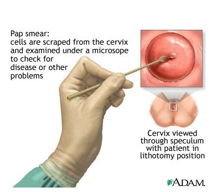 What do Pap smears test for?
